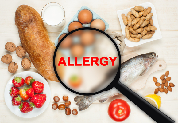 Level 3 Management of Food Allergies Awareness on Campus
